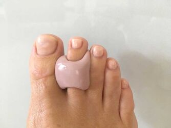 Orthosen Behandlung - Podo-Logik - Schleswig